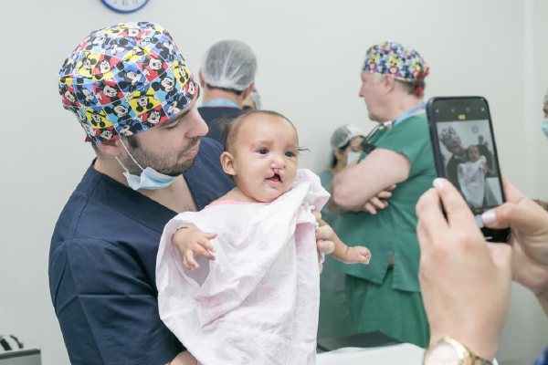 Operação Sorriso oferece cirurgias gratuitas para fissura labiopalatina em Santarém